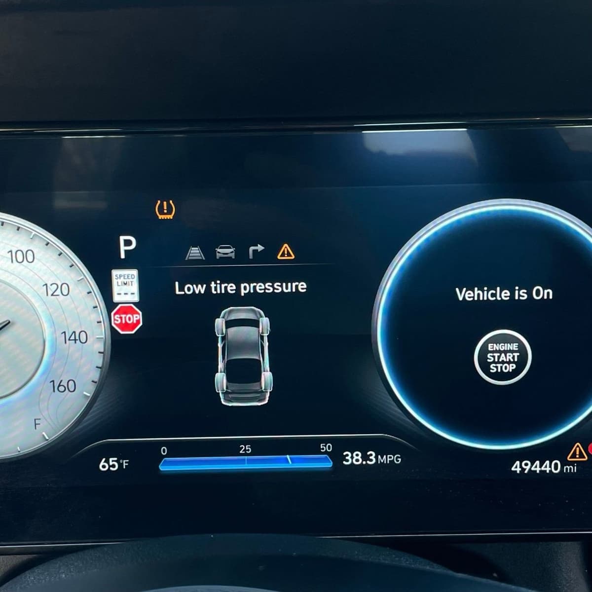 2024 Hyundai Elantra - Image 15