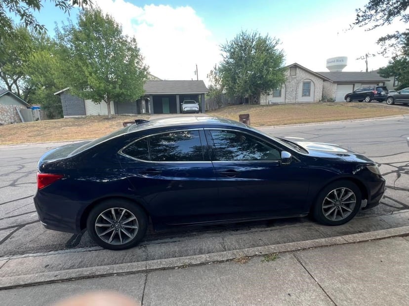 2018 Acura Tlx - Image 1